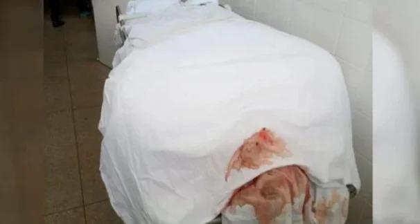 Corpo de vítima de Covid-19 apodrece há 24h em hospital