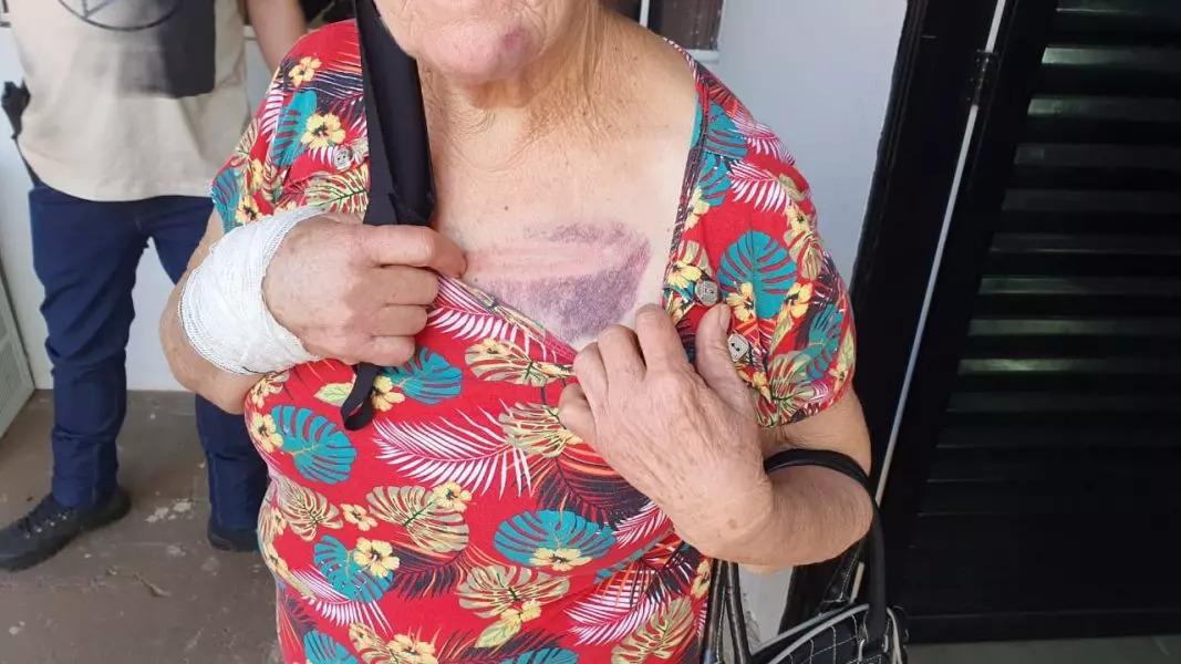 Por causa de celular, neto quebra o braço da avó de 70 anos em Paiçandu