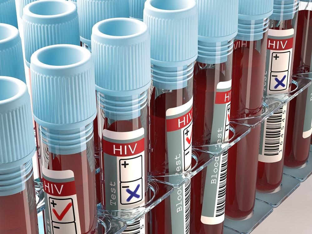 Moderna começará a testar vacina contra HIV em humanos nos Estados Unidos
