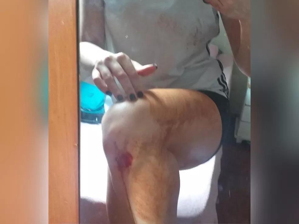 em Londrina, mulher é atacada por homem enquanto praticava exercícios e fica ferida