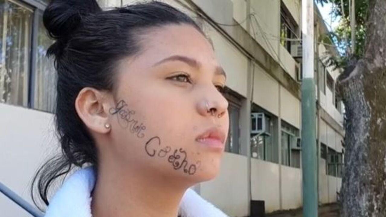 Jovem tatuada à força com nome de ex-namorado no rosto diz que sofreu sessão de tortura