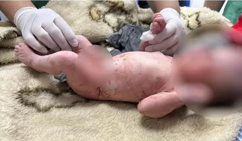 Recém-nascida é encontrada viva sem roupa dentro de sacola de lixo